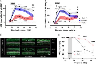 Cochlin Deficiency Protects Against Noise-Induced Hearing Loss